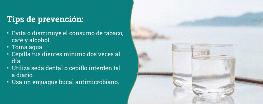Halitosis: cómo prevenirla